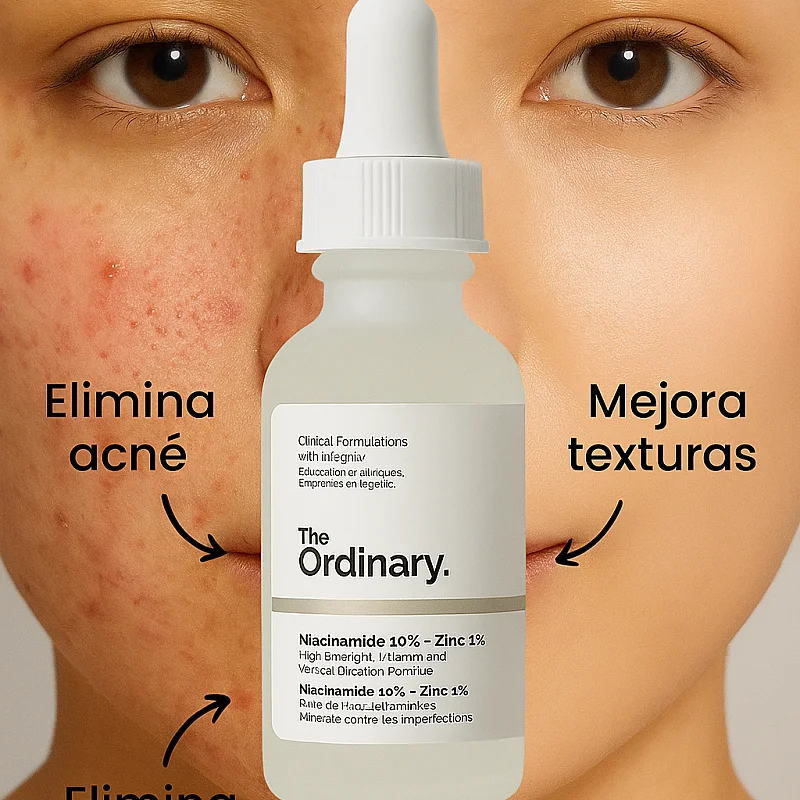 Niacinamida 10% + Zinc 1% the ordinary — imagen principal